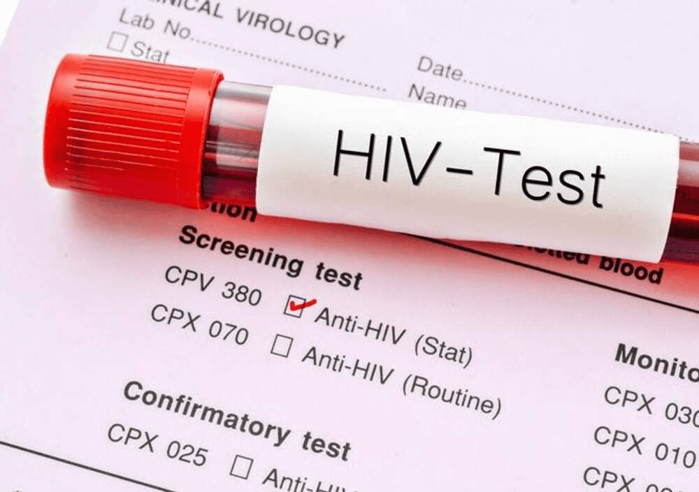 Life Insurance for People Living with HIV: What You Need to Know